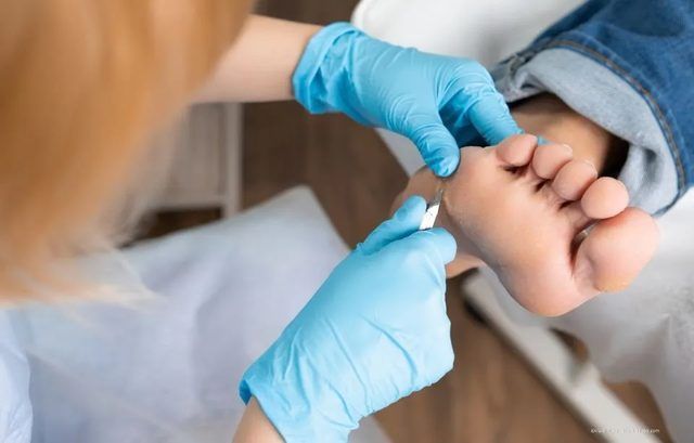 Eine Ärztin mit Handschuhen reinigt den Fuß eines Patienten mit einem Wattepad