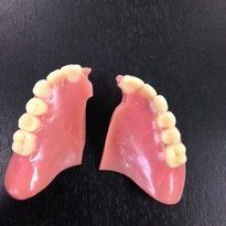 Laboratoire dentaire Chantal Clerc - Stellites et gouttières