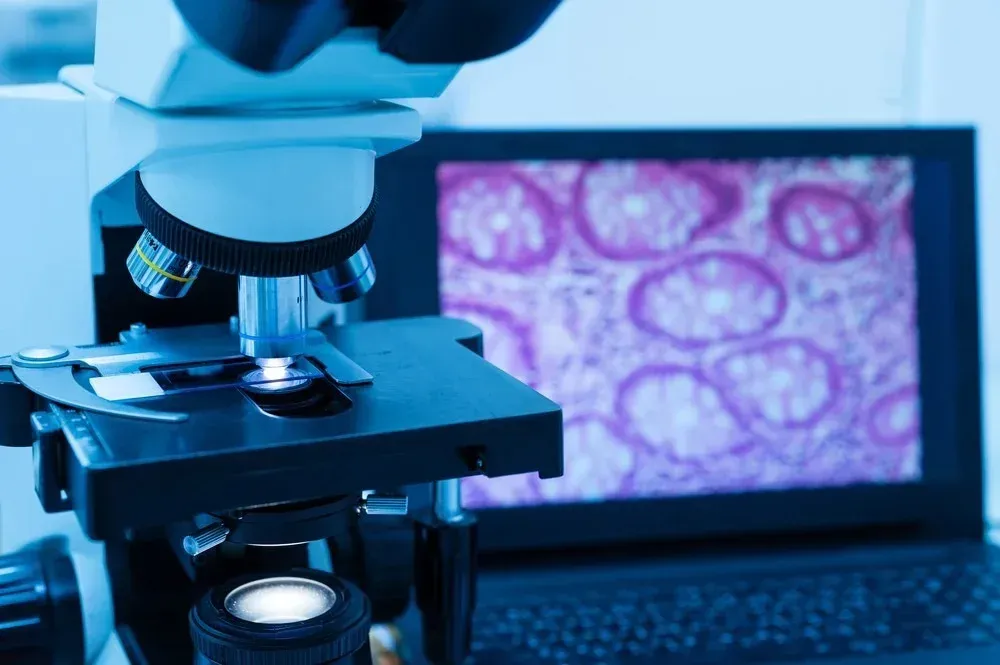 Microscopio con portaobjetos, observación de una muestra de tejido en una pantalla de computadora portátil, entorno de laboratorio con luz azul.