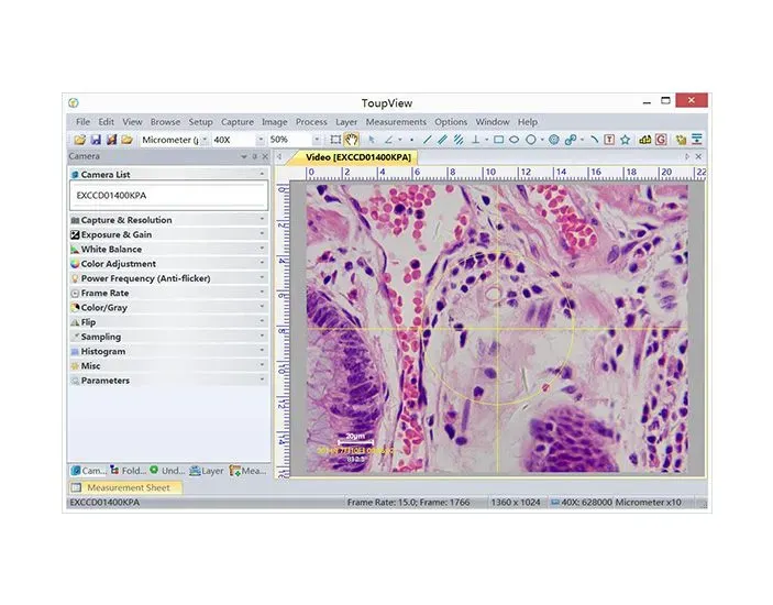Captura de pantalla de un software que muestra una muestra de tejido microscópico, centrada en los vasos sanguíneos y las células con distintos tonos de rosa y morado.
