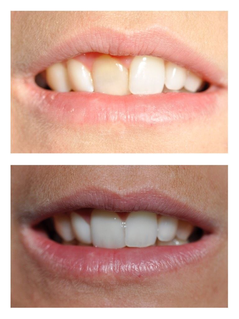 Cabinet dentaire - Valérie Holz - Genève