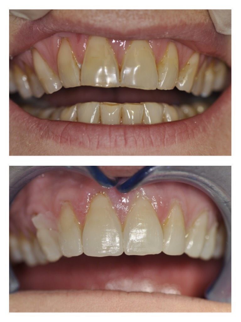 Cabinet dentaire - Valérie Holz - Genève