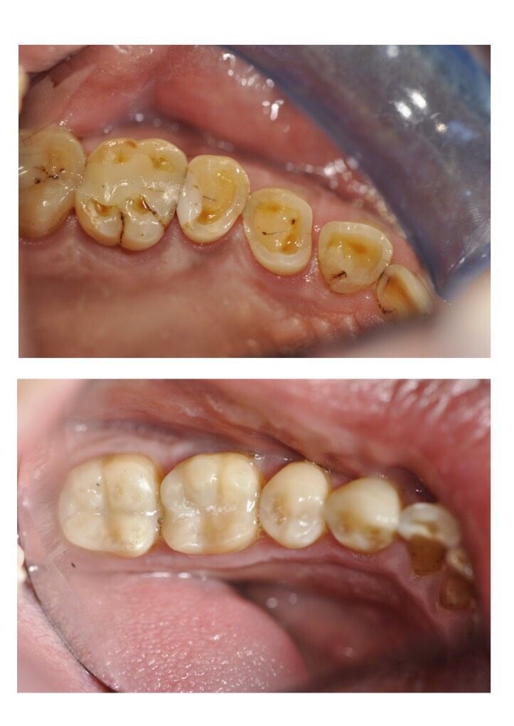 Cabinet dentaire - Valérie Holz - Genève