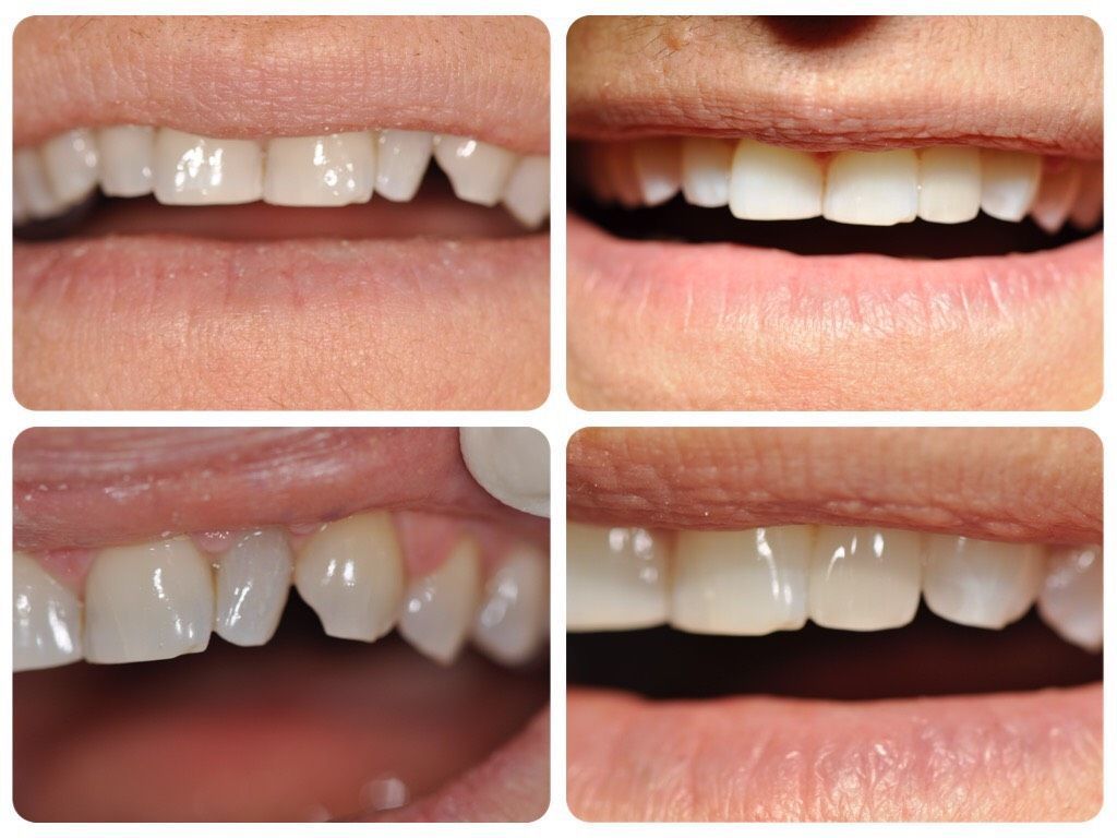 Cabinet dentaire - Valérie Holz - Genève