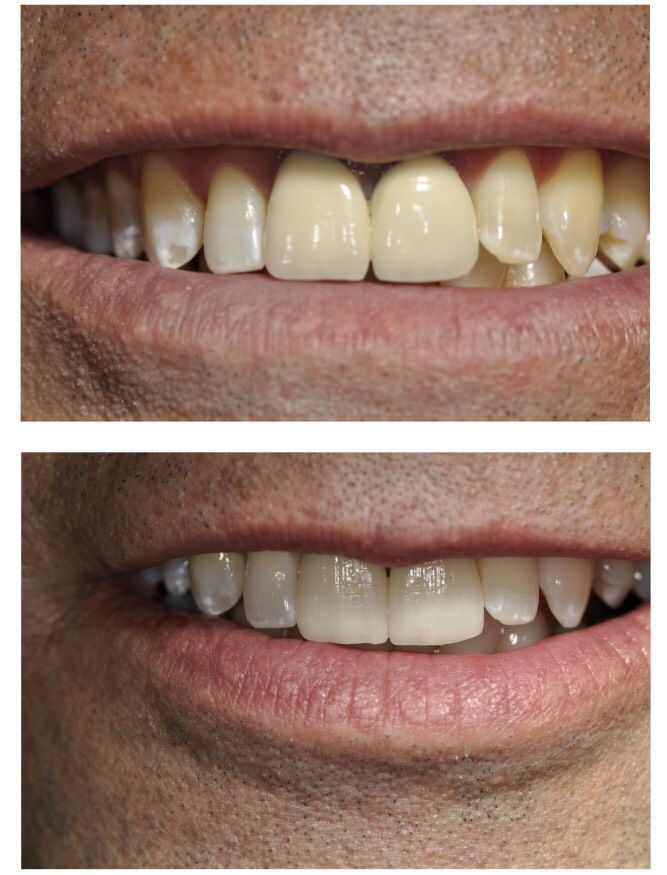 Cabinet dentaire - Valérie Holz - Genève