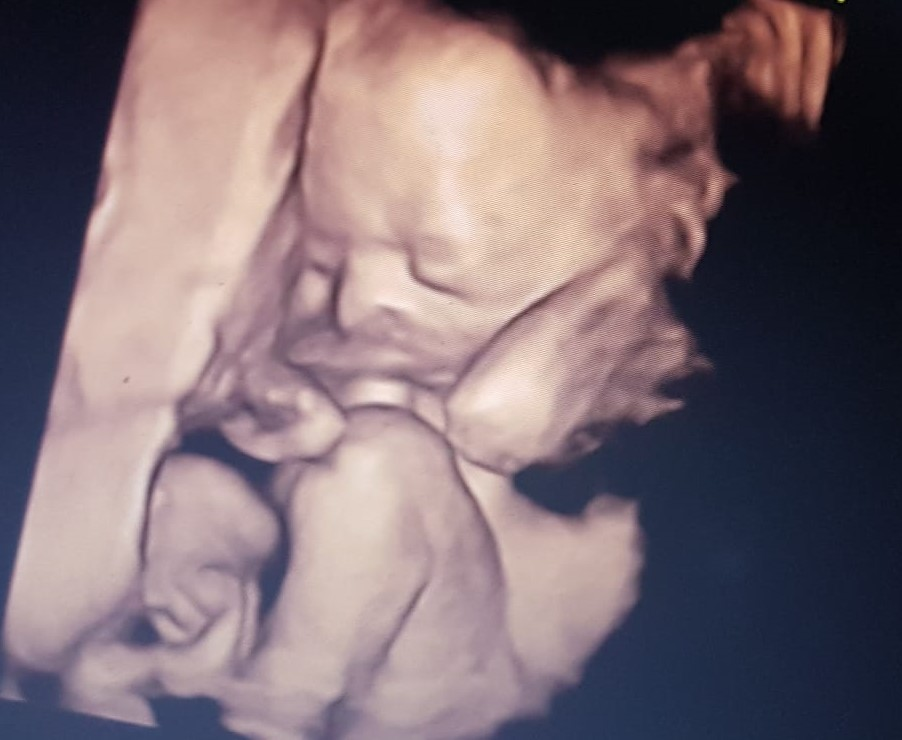 ecografia 3D porto
