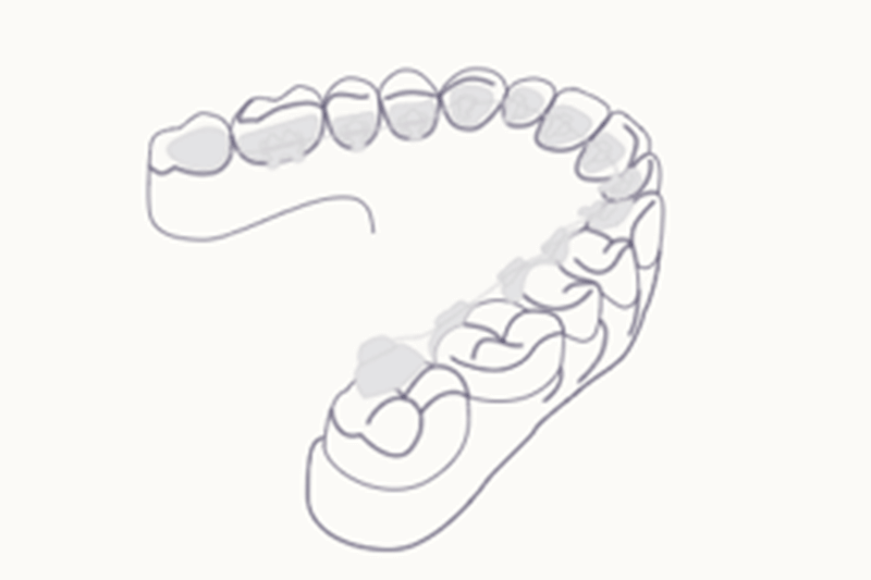 Strichzeichnung eines Zahnbogens mit sichtbaren Zähnen, die deren Form und Anordnung darstellt.