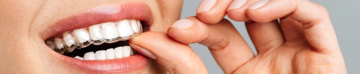 Un primer plano de la boca y los dientes de una mujer con sus manos.