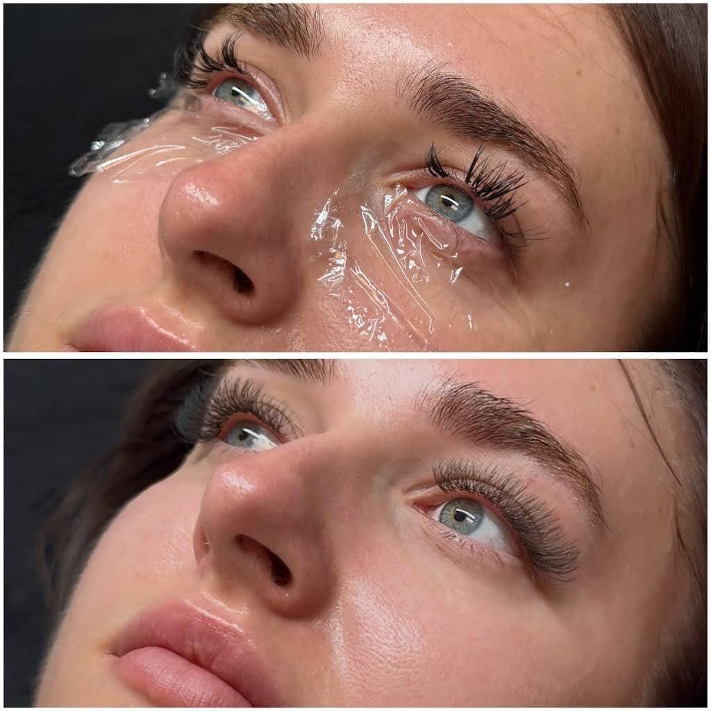 Primer plano de un rostro con ojeras brillantes, antes y después de su eliminación.