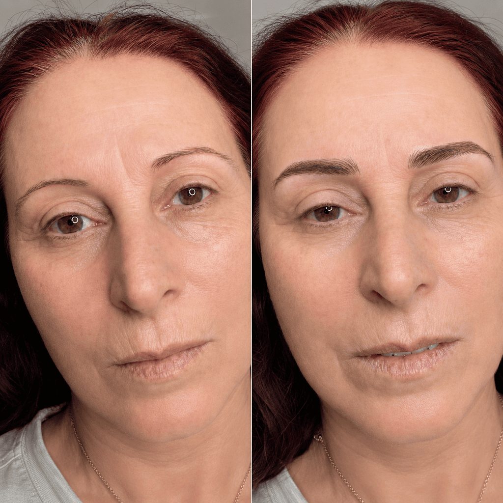 Retratos comparativos de la misma mujer con expresión neutra, que muestran diferentes niveles de iluminación o retoques.