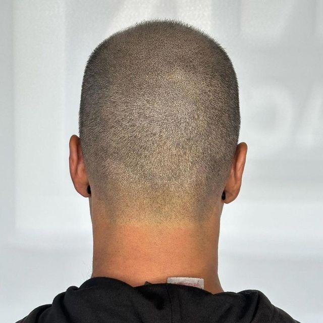 Primer plano de la cabeza de un hombre calvo con barba fina. Se ven el ojo y la frente.