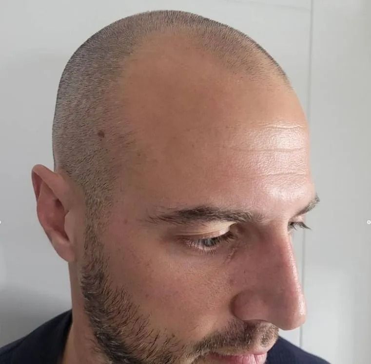 Un hombre con la cabeza rapada y barba incipiente mirando hacia abajo; expresión neutra.