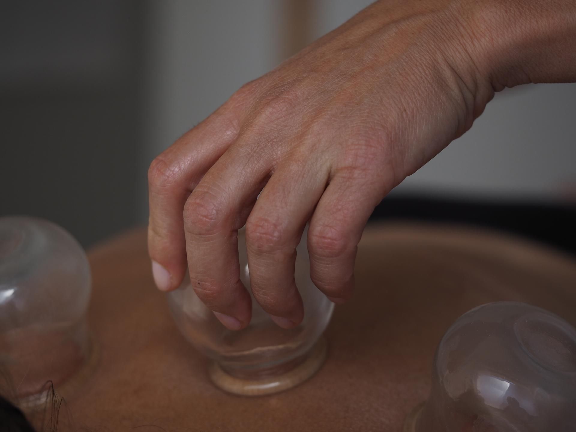 Main posant une ventouse sur la peau nue lors d'un traitement thérapeutique
