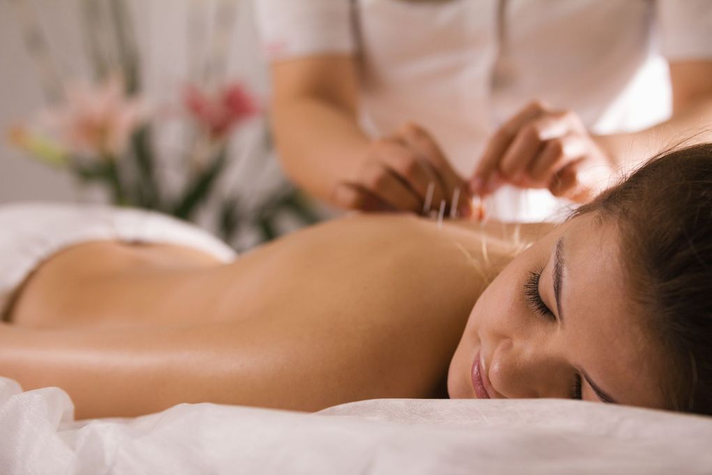 Une personne recevant une thérapie par ventouses sur le dos nu dans un spa