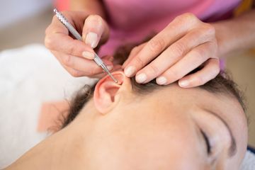 Main utilisant un outil métallique d'acupunture sur l'oreille d'une personne lors d'un traitement