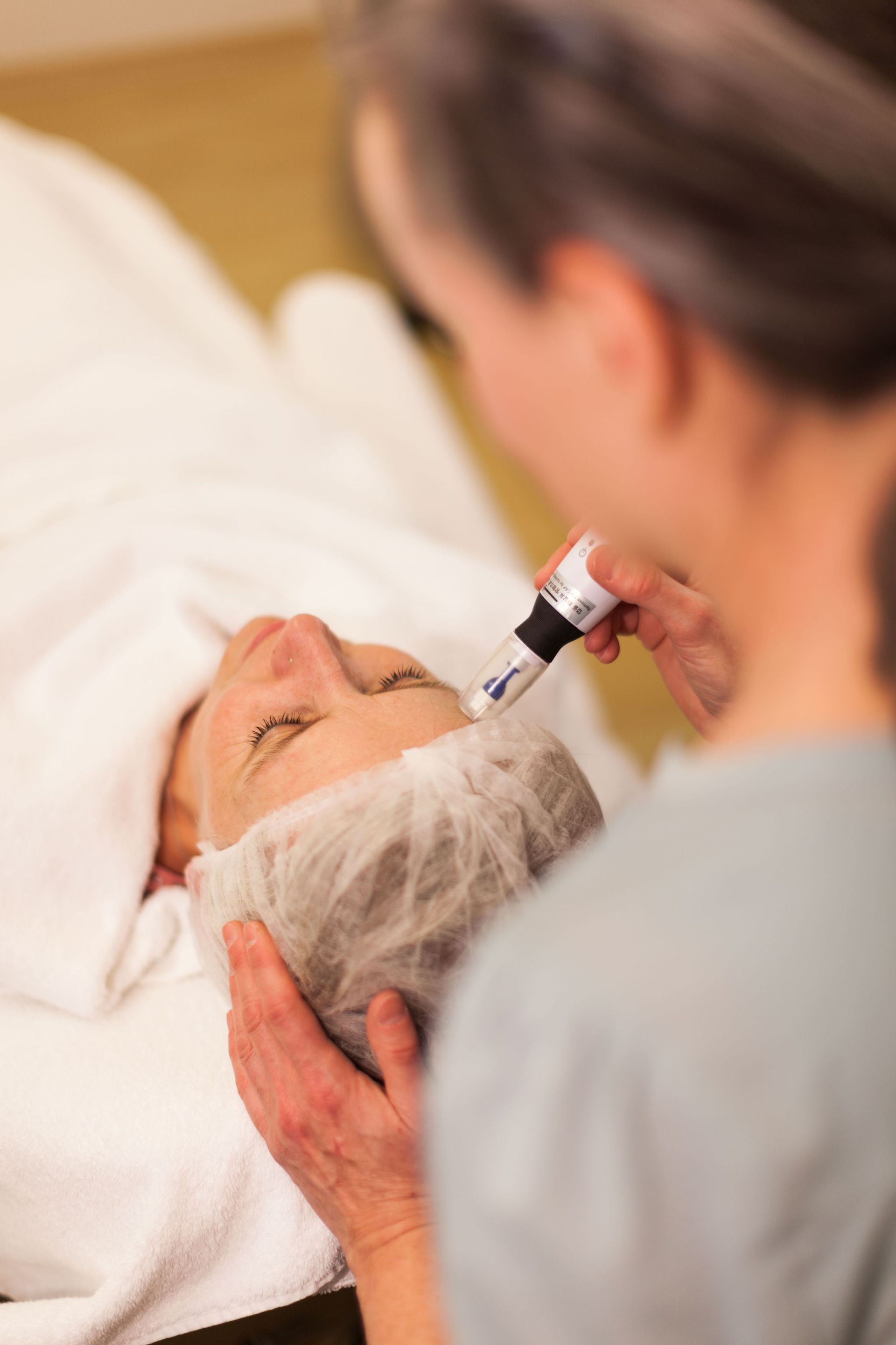 Best-Aging - Microneedling