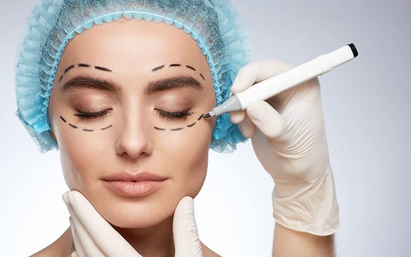 Ein Chirurg zeichnet mit einem Marker Linien auf das Gesicht einer Frau.