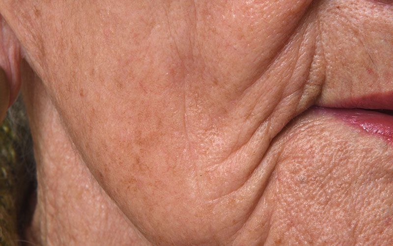 Eine Nahaufnahme des Gesichts einer älteren Frau mit Falten und roten Lippen.