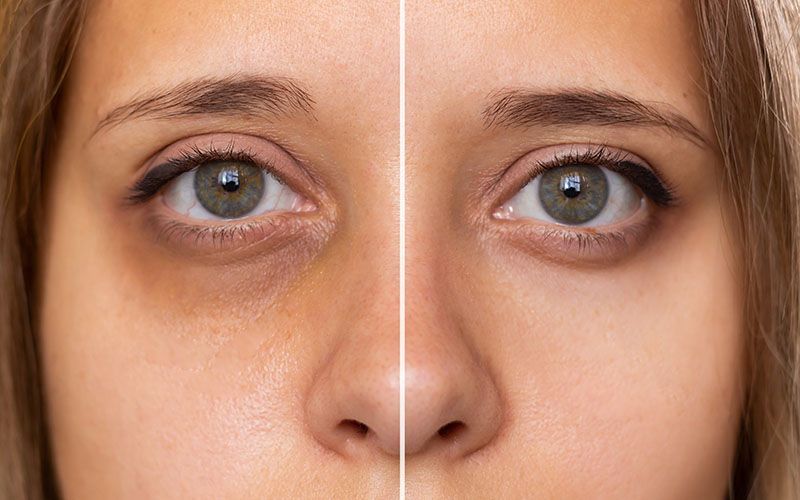 Ein Vorher-Nachher-Foto der Augen einer Frau mit und ohne Make-up.