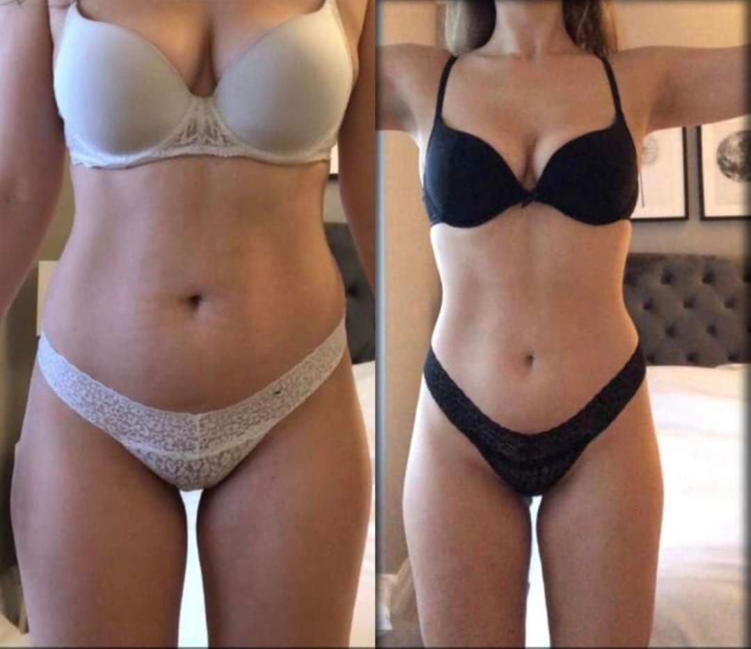 Side-by-side comparison: woman in white then black lingerie, showing weight loss in front of a bed.