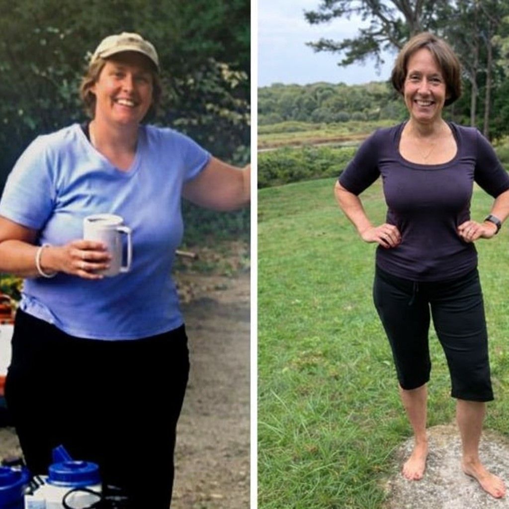 Woman, before and after weight loss.  Left: smiling in blue shirt. Right: standing,  in purple shirt. Outdoor setting.