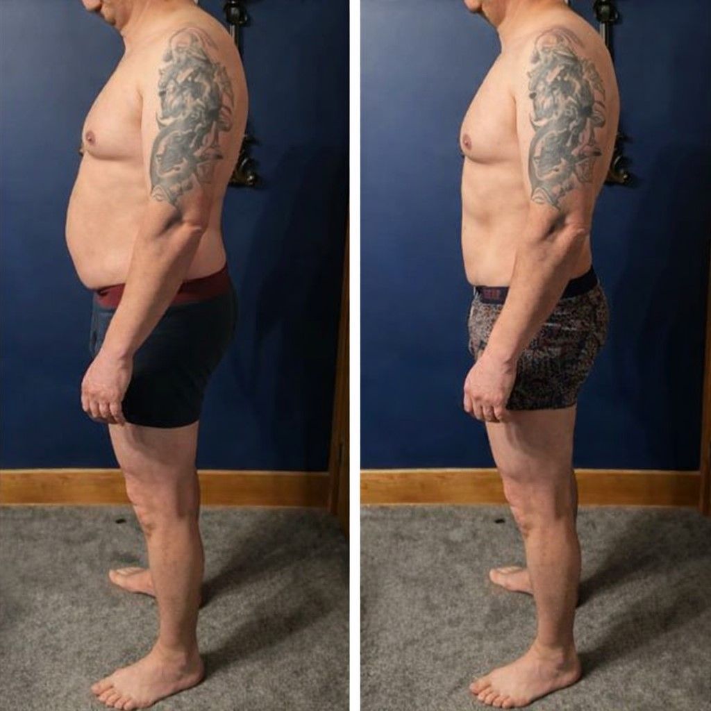 Two side-view photos show a person's torso. Left: Overweight with a visible belly. Right: Slimmer with less belly fat.