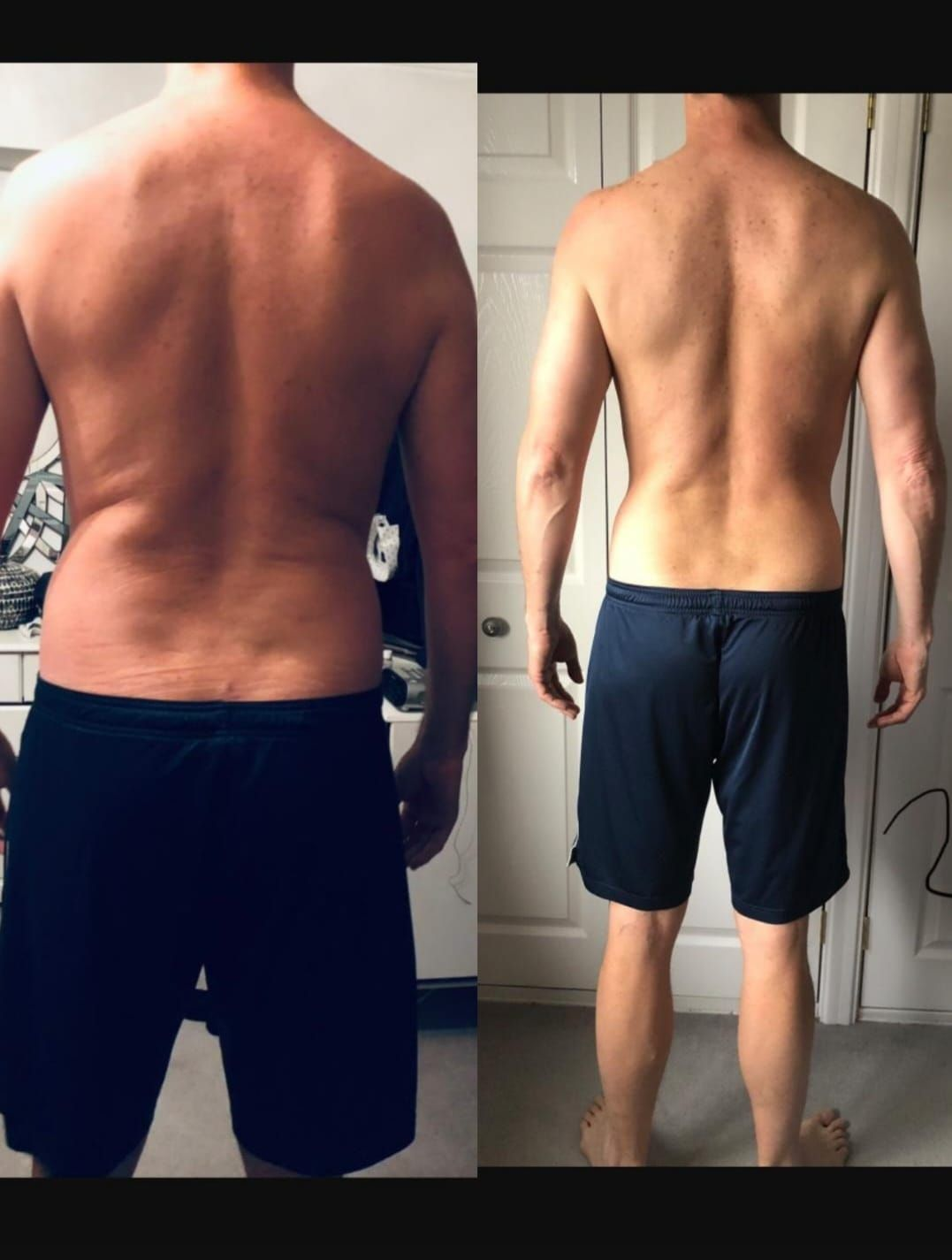 Two side-by-side photos of a person's back. Before photo shows more body fat. After photo shows toned back.