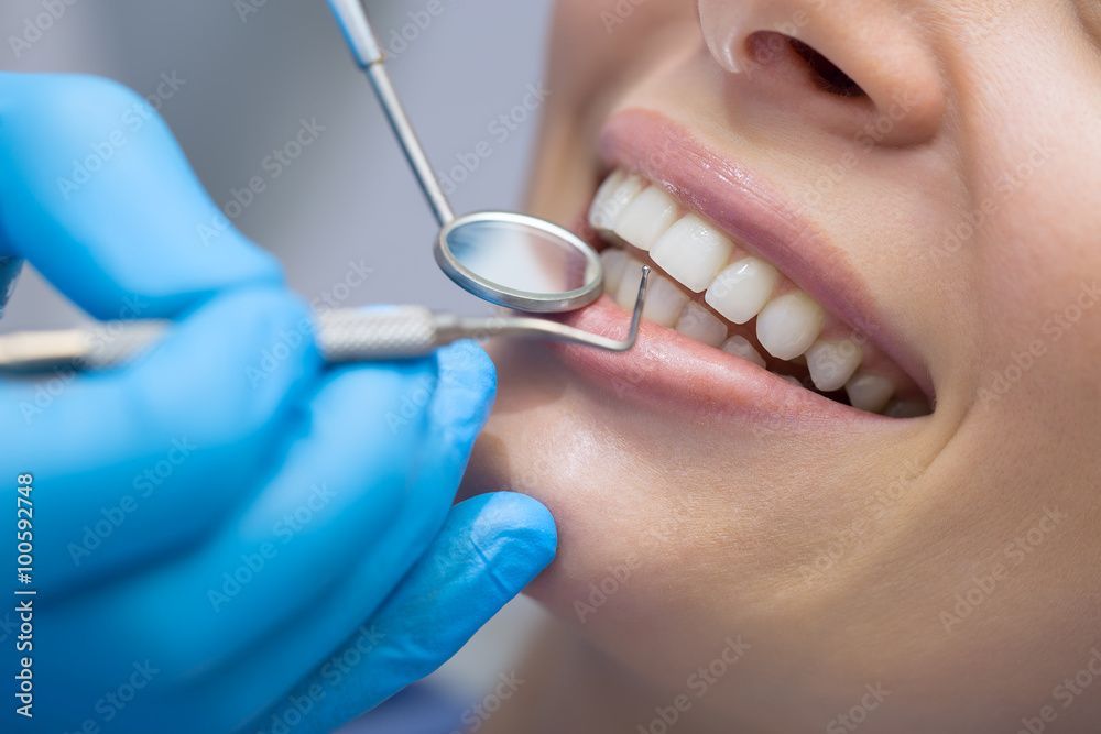 Dentista che esamina i denti con uno specchio e una sonda; la bocca del paziente è aperta. Guanti blu visibili.