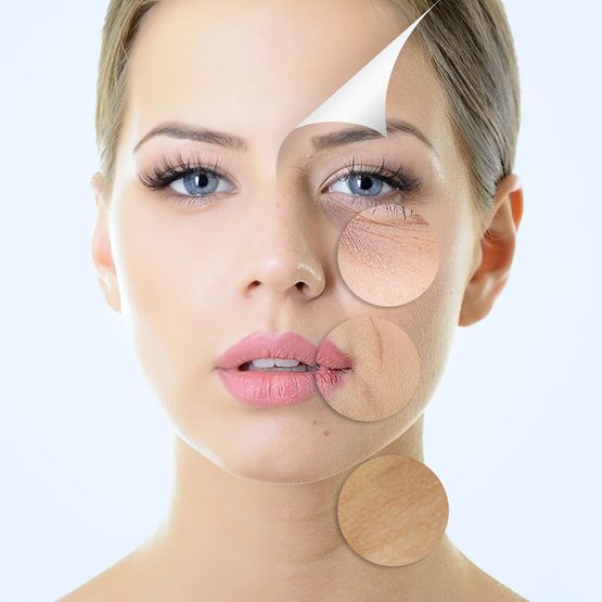Rostro de mujer con círculos de comparación de maquillaje que muestran diferentes tonos y texturas de piel.