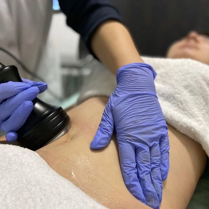 Un profesional sanitario con guantes utiliza un dispositivo portátil en el abdomen de un paciente durante una sesión de tratamiento.