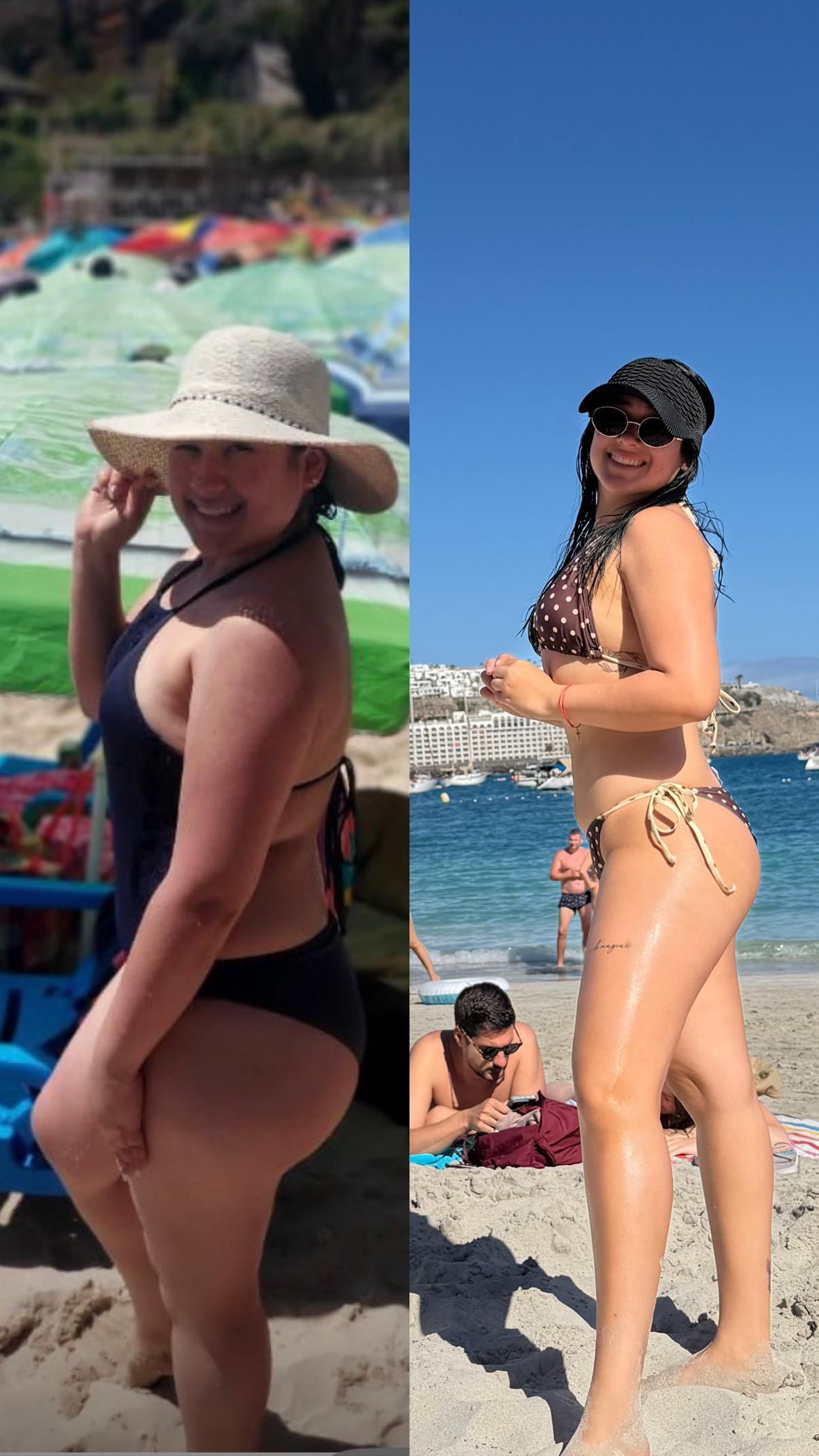 Dos espaldas una al lado de la otra, mostrando una diferencia en la línea del bronceado desde el hombro hasta la cintura.