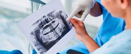 Un dentista está mirando una radiografía de los dientes de un paciente.