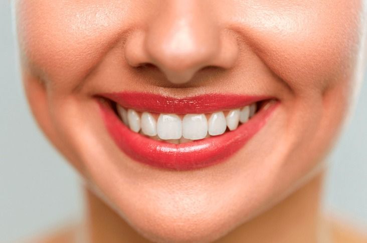 Un primer plano de la sonrisa de una mujer con dientes blancos y lápiz labial rojo.