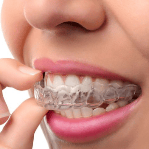 اجمل ابتسامة في الياسمين 