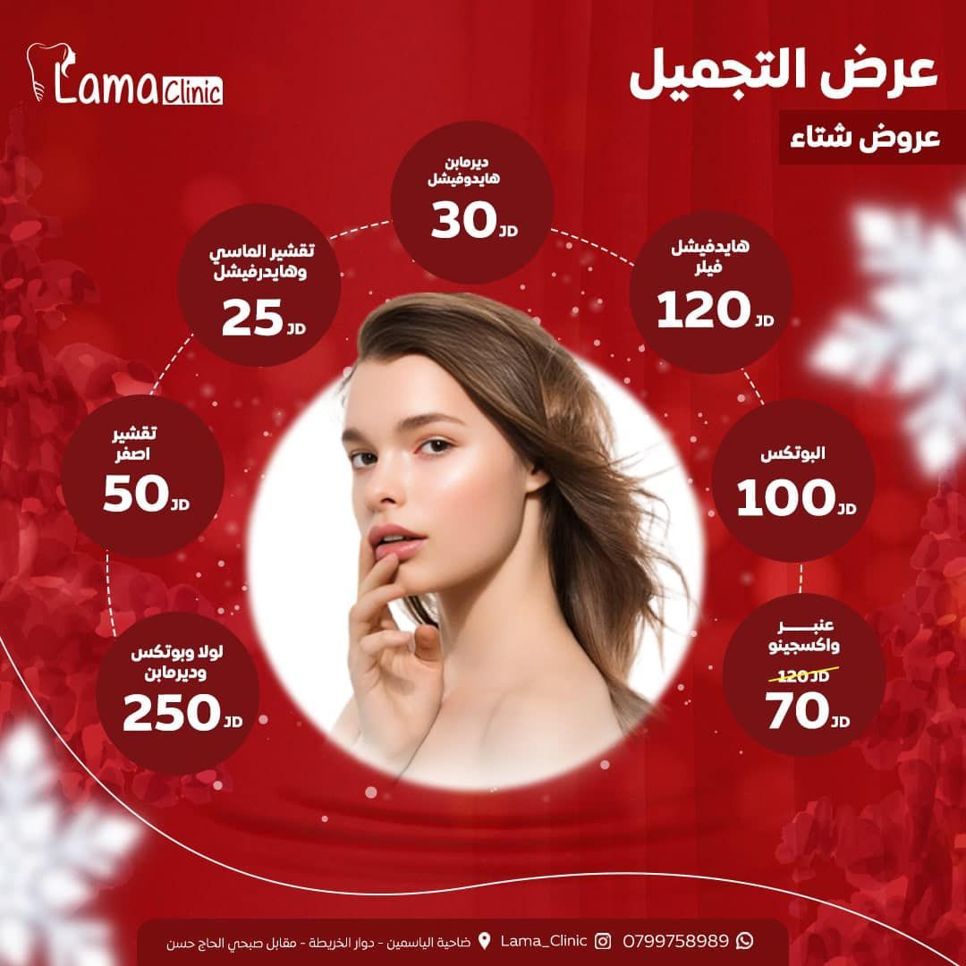 لومينير الأسنان (Lumineers)
