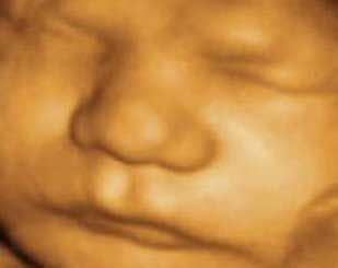 Ecografía 3D de la cara de un bebé, mostrando la nariz y la boca, en tonos marrones.