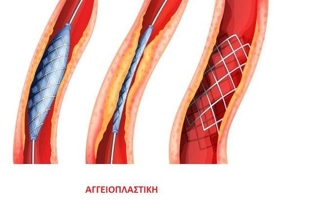 Καρδιολόγος - Στρατιωτικός Ιατρός Τσέλιος Ανδρέας