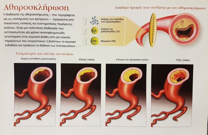 Καρδιολόγος - Στρατιωτικός Ιατρός Τσέλιος Ανδρέας