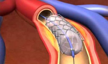 Καρδιολόγος - Στρατιωτικός Ιατρός Τσέλιος Ανδρέας