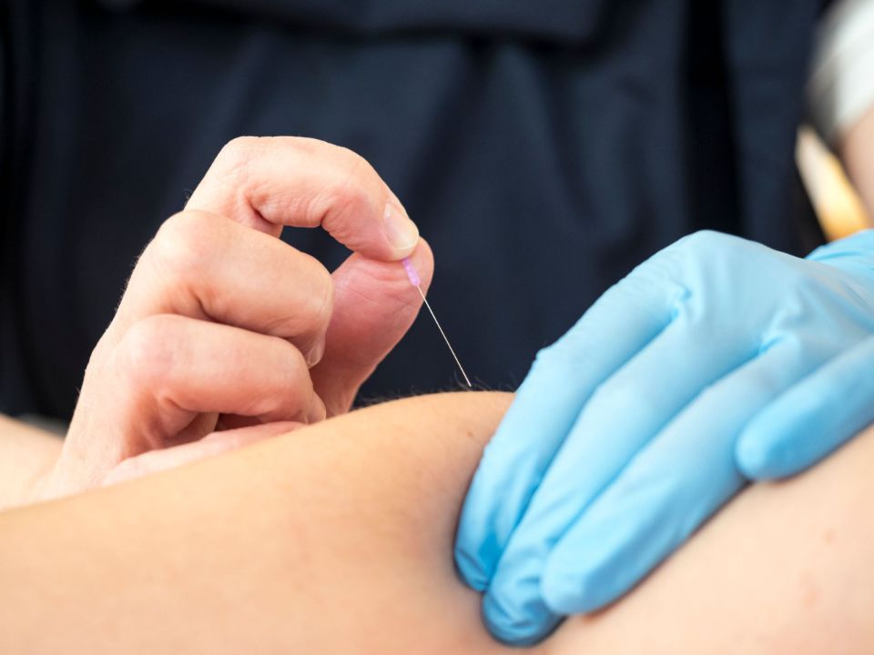 Akupunktur in der Praxis Physiotherapie Obstgarten