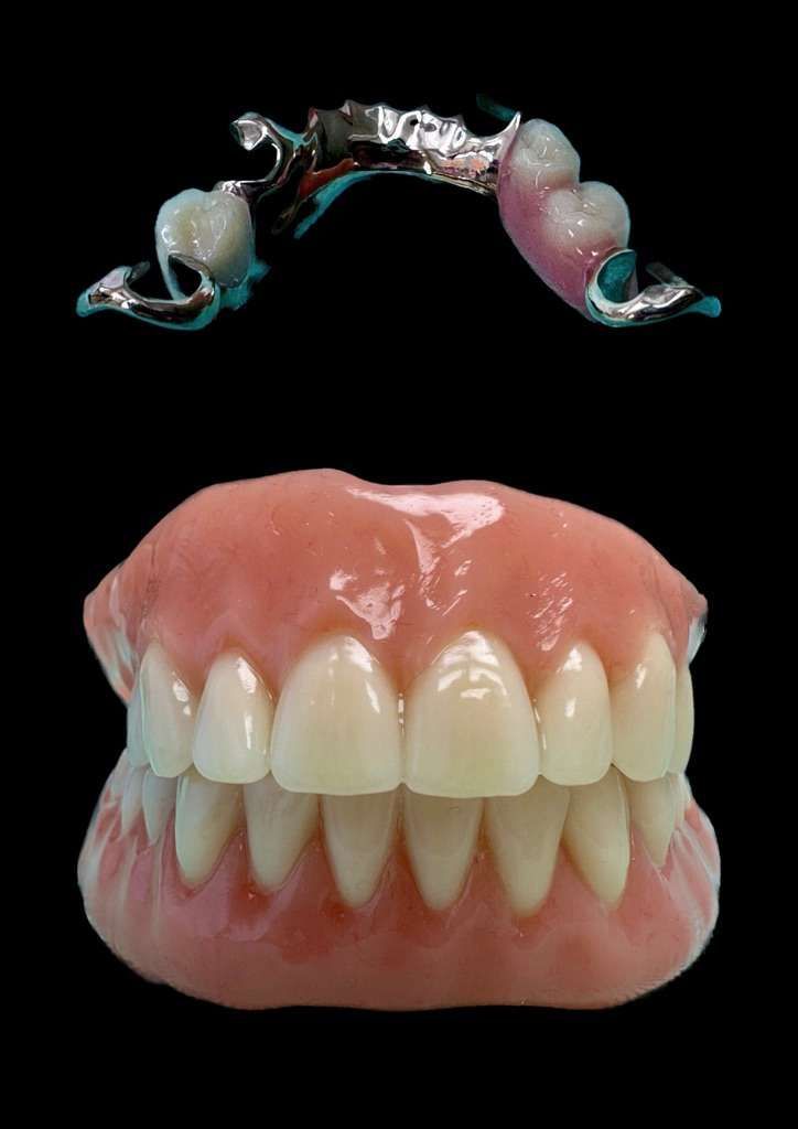 Zahnprothetik Zürich Orribile Alberto Zürich