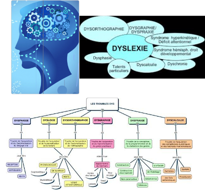 Schéma bilan neuropsychologique