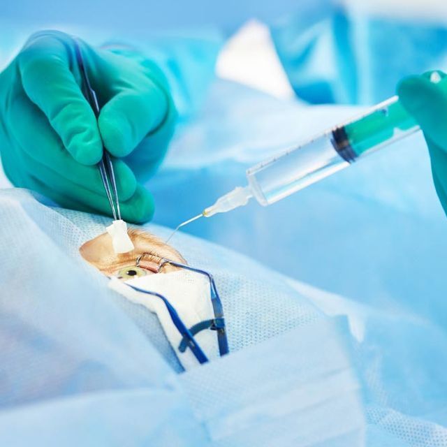 Un cirujano sostiene una jeringa sobre el ojo de un paciente.