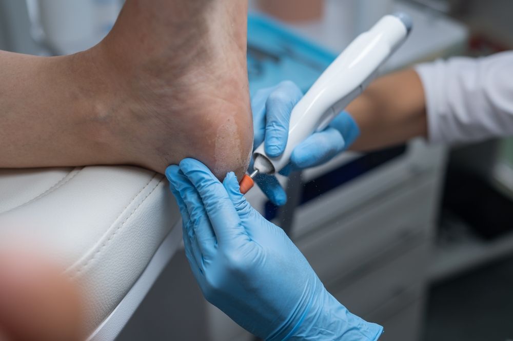 Un primer plano del pie de una persona siendo tratado por un médico.