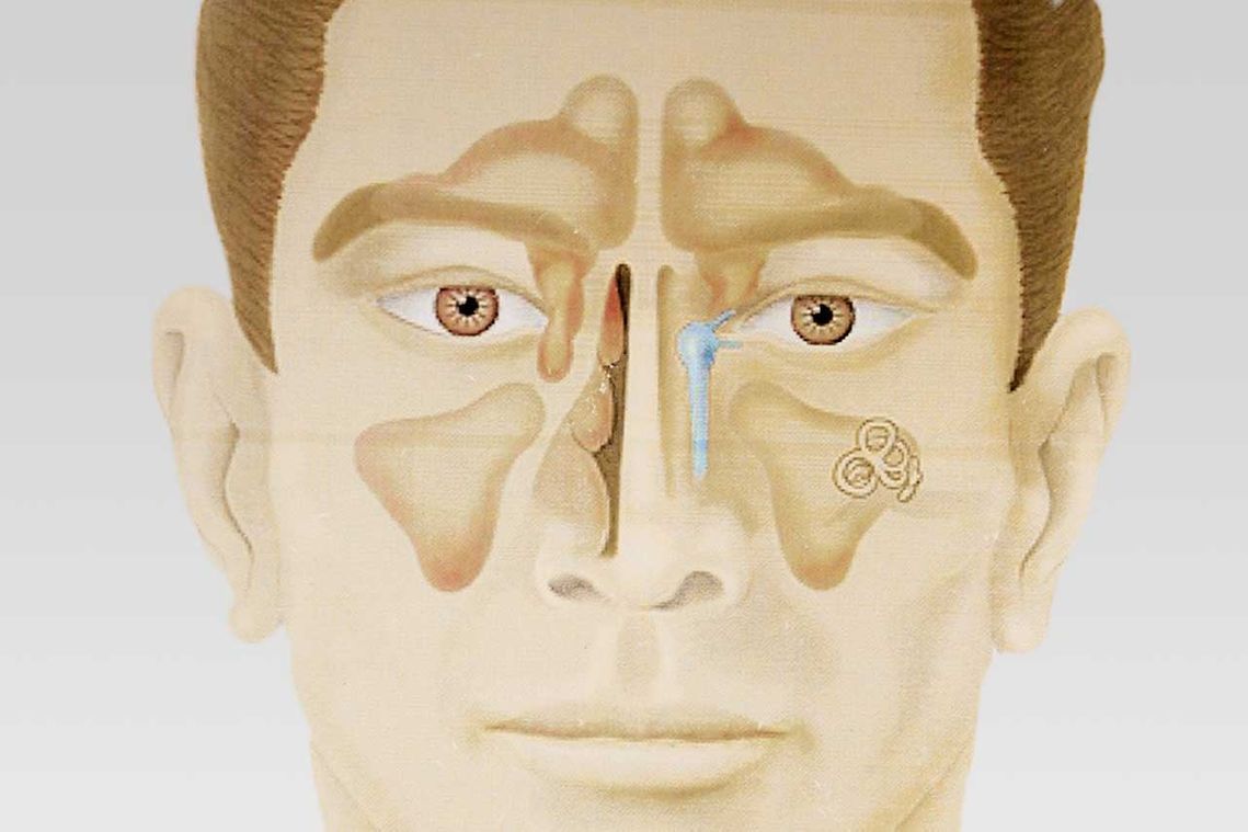Nasen-Nasennebenhöhlen-Chirurgie