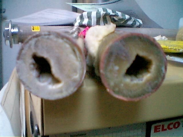 Calcaire et détartrage - Romisa S. Authouart