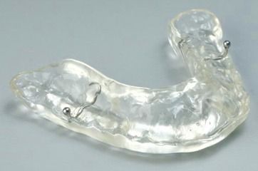 Retenedor dental de plástico transparente con accesorios de alambre.
