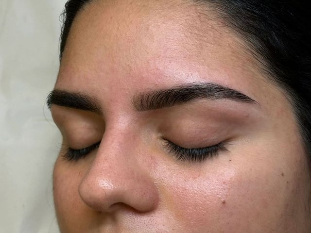 Primer plano del rostro de una persona con los ojos cerrados y una pequeña imperfección en la mejilla.