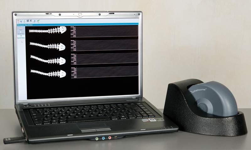 Auf dem Laptop werden Röntgenbilder der Wirbelsäule angezeigt, ein Gerät zum Vermessen befindet sich in der Ladestation.