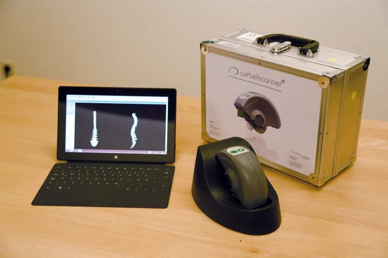 Ein Laptop mit einer Röntgenaufnahme der Wirbelsäule, daneben ein Scanner und ein mit „Spinescan“ beschrifteter Transportkoffer. Das Ganze steht auf einem Holztisch. Ein Laptop mit einer Röntgenaufnahme der Wirbelsäule, daneben ein Scanner und ein mit „Spinescan“ beschrifteter Transportkoffer. Das Ganze steht auf einem Holztisch.